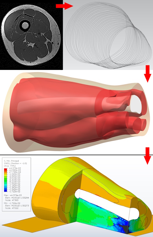 3D model of human thigh